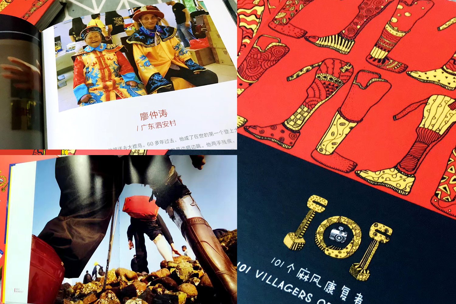 Design for Good - 101个麻风康复者